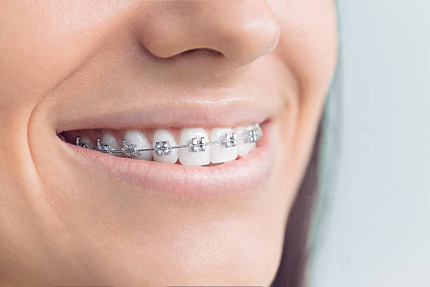 Best Teeth Whitening  in Matthews, NC